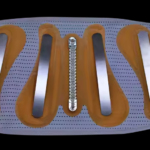 waist brace support belt' inside support metal shows