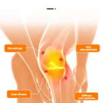 Red light therapy knee pads