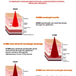 Red light therapy wrist guard